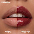 Lip Glow Serum Cherry Soda Dr Akerman´s Ultra Hidratante Filler Progresivo No pegajoso